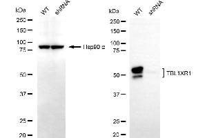 Western blotting analysis using TBL1XR1 antibody (ABIN7800597). (TBL1XR1 anticorps)