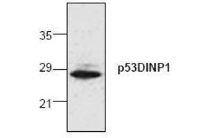 Image no. 1 for anti-Tumor Protein P53 Inducible Nuclear Protein 1 (TP53INP1) (N-Term) antibody (ABIN155075) (TP53INP1 anticorps  (N-Term))