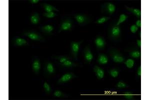 Immunofluorescence of monoclonal antibody to SMAD1 on HeLa cell.