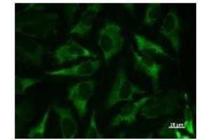 Immunostaining analysis in HeLa cells.