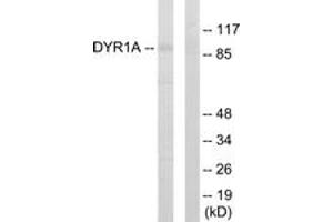 Western blot analysis of extracts from HepG2 cells, using DYR1A Antibody. (DYRK1A anticorps  (AA 21-70))