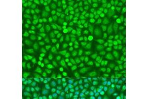 Immunofluorescence analysis of U2OS cells using HOXB5 Polyclonal Antibody at dilution of 1:100. (HOXB5 anticorps)