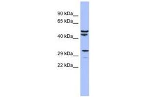 Image no. 1 for anti-Mitochondrial Ribosomal Protein S15 (MRPS15) (AA 35-84) antibody (ABIN6742891) (MRPS15 anticorps  (AA 35-84))