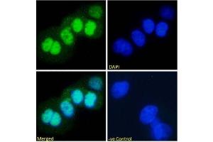 Immunofluorescence staining of fixed A431 with anti-p53 antibody PAb421. (Recombinant p53 anticorps  (AA 371-380))