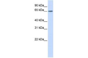 YTHDF3 antibody used at 1 ug/ml to detect target protein. (YTHDF3 anticorps  (N-Term))
