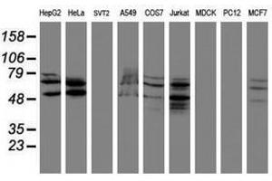 Image no. 2 for anti-SUMO1/sentrin/SMT3 Specific Peptidase 2 (SENP2) (AA 139-523) antibody (ABIN1490926) (SENP2 anticorps  (AA 139-523))