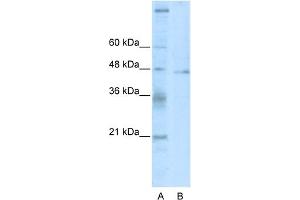 WB Suggested Anti-TSG101 Antibody Titration:  2. (TSG101 anticorps  (C-Term))