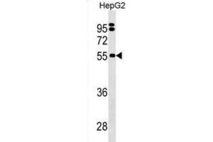 Western Blotting (WB) image for anti-Sep (O-phosphoserine) tRNA:Sec (Selenocysteine) tRNA Synthase (SEPSECS) antibody (ABIN3000193) (SEPSECS anticorps)
