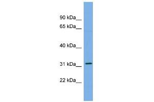 WB Suggested Anti-CDCA5 Antibody Titration: 0. (CDCA5 anticorps  (Middle Region))