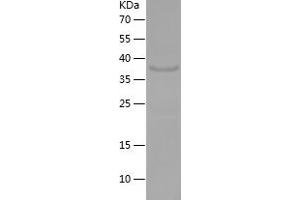 Western Blotting (WB) image for Fibroblast Growth Factor 22 (FGF22) (AA 23-170) protein (His-IF2DI Tag) (ABIN7122936)