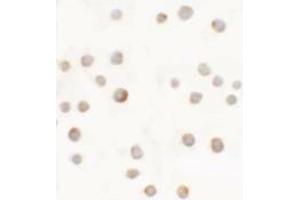 Immunocytochemistry of ABCA7 in 293 cells with ABCA7 antibody at 5 ug/mL.