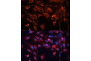 Immunofluorescence analysis of C6 cells using Cation-independent M6PR (Cation-independent M6PR (IGF2R)) antibody (ABIN6130063, ABIN6142247, ABIN6142248 and ABIN6216853) at dilution of 1:100. (IGF2R anticorps  (AA 2327-2491))