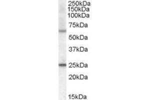Image no. 1 for anti-Collagen, Type IV, alpha 3 (Goodpasture Antigen) Binding Protein (COL4A3BP) (Internal Region) antibody (ABIN374934) (COL4A3BP anticorps  (Internal Region))
