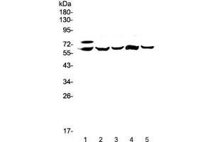 Western blot testing of 1) human HepG2, 2) rat liver, 3) rat lung, 4) mouse liver and 5) mouse lung lysate with Carboxylesterase 1 antibody at 0.