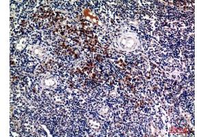 Immunohistochemistry (IHC) analysis of paraffin-embedded Human Tonsils, antibody was diluted at 1:100. (Syndecan 1 anticorps  (Internal Region))