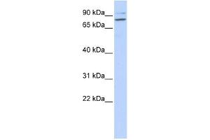 WB Suggested Anti-PLCD1 Antibody Titration: 0. (PLCD1 anticorps  (N-Term))