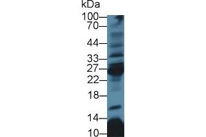 Western Blot; Sample: Rat Thymus lysate; Primary Ab: 3µg/ml Rabbit Anti-Human CD8b Antibody Second Ab: 0. (CD8B anticorps  (AA 22-170))