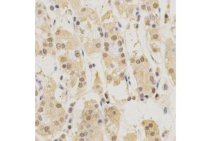 Immunohistochemistry of paraffin-embedded human stomach using PSMB5 antibody at dilution of 1:200 (x400 lens).
