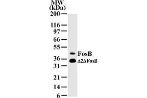 Western Blotting (WB) image for anti-FBJ Murine Osteosarcoma Viral Oncogene Homolog B (FOSB) (AA 2-15) antibody (ABIN207980) (FOSB anticorps  (AA 2-15))