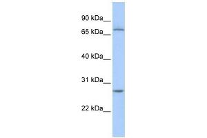 RCHY1 antibody used at 1 ug/ml to detect target protein. (RCHY1 anticorps  (N-Term))