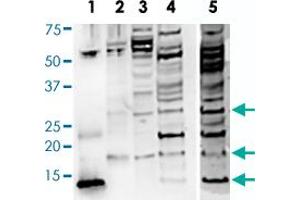 Western Blot analysis of (1) BDNF of rhBDNF R-088-100 (whole serum), (2) BDNF-isoform of rhBDNF R-088-100 (whole serum), (3) SHSY5Y of rhBDNF R-088-100 (whole serum), (4) Human brain of rhBDNF R-088-100 (whole serum), (5) Human brain of R-017-500 (IgG, 10 ug/mL), monomeric BDNF at 14 kDa and proBDNF is detected at the expected molecular weight of 32 kDa for glycosylated proBDNF monomer. (BDNF anticorps)
