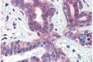 Human Breast (formalin-fixed, paraffin-embedded) stained with XBP1 antibody ABIN337110 at 5 ug/ml followed by biotinylated anti-goat IgG secondary antibody ABIN481715, alkaline phosphatase-streptavidin and chromogen. (XBP1 anticorps  (AA 358-372))