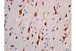 Formalin-fixed and paraffin embedded rat brain labeled with Rabbit Anti-KIBRA Polyclonal Antibody, Unconjugated (ABIN1387477) at 1:200 followed by conjugation to the secondary antibody and DAB staining