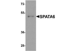 Western blot analysis of SPATA6 in A20 cell lysate with SPATA6 Antibody  at 1 µg/ml. (SPATA6 anticorps  (C-Term))