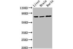Western Blot Positive WB detected in: Rat liver tissue, Rat brain tissue, Mouse brain tissue All lanes: Hspa5 antibody at 3 μg/mL Secondary Goat polyclonal to rabbit IgG at 1/50000 dilution Predicted band size: 73 kDa Observed band size: 73 kDa