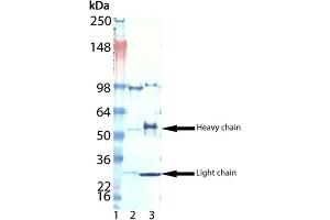 Western blot analysis of Digoxigenin, pAb : Lane 1: MW marker, Lane 2: LTC4, mAb (Digoxingenin conjugate), Lane 3: IL-8, mAb (Digoxigenin conjugate). (Digoxigenin, Digoxin anticorps)