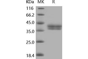 Western Blotting (WB) image for Carbonic Anhydrase 12 (CA12) (Active) protein (His tag) (ABIN7194556)