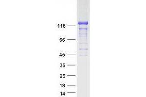 Validation with Western Blot