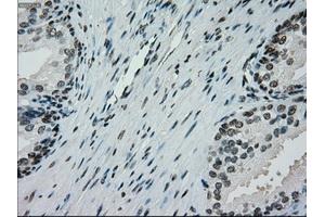 Image no. 12 for anti-Premelanosome Protein (PMEL) antibody (ABIN1500300)