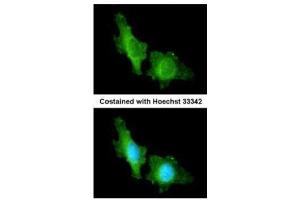 ICC/IF Image Immunofluorescence analysis of methanol-fixed HeLa, using CNGA2, antibody at 1:200 dilution. (CNGA2 anticorps  (C-Term))