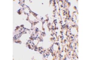 Immunohistochemical staining of mouse lung tissue using AP30147PU-N Bid antibody at 2 μg/ml. (BID anticorps  (C-Term))