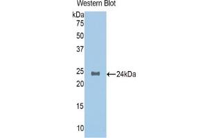 Western blot analysis of the recombinant protein. (NAGA anticorps  (AA 218-411))