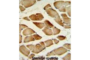 Immunohistochemistry (IHC) image for anti-Cathepsin F (CTSF) antibody (ABIN3002689)