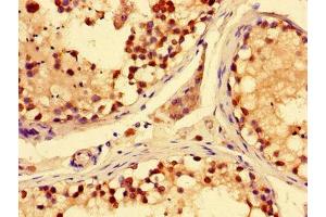 Immunohistochemistry of paraffin-embedded human testis tissue using ABIN7170219 at dilution of 1:100 (SLC28A3 anticorps  (AA 1-102))
