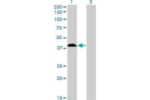 Western Blot analysis of MGC26963 expression in transfected 293T cell line by MGC26963 monoclonal antibody (M08), clone 7D10. (Sphingomyelin Synthase 2 anticorps  (AA 2-80))