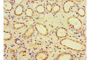 Immunohistochemistry of paraffin-embedded human kidney tissue using ABIN7147518 at dilution of 1:100 (CHMP1B anticorps  (AA 1-199))
