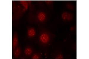 Image no. 3 for anti-Forkhead Box O4 (FOXO4) (pSer197) antibody (ABIN196850) (FOXO4 anticorps  (pSer197))