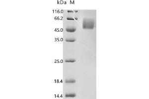 (Tris-Glycine gel) Discontinuous SDS-PAGE (reduced) with 5 % enrichment gel and 15 % separation gel.
