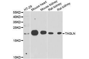 Western blot analysis of extracts of various cell lines, using TAGLN antibody. (Transgelin anticorps  (AA 1-201))