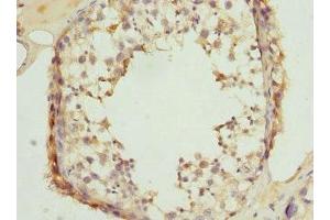 Immunohistochemistry of paraffin-embedded human testis tissue using ABIN7147935 at dilution of 1:100 (CLASP1 anticorps  (AA 1389-1538))