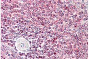 Human Spleen: Formalin-Fixed, Paraffin-Embedded (FFPE) (IST1 anticorps  (AA 125-317))