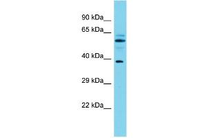 Host: Rabbit Target Name: MACROD1 Sample Type: Fetal Brain lysates Antibody Dilution: 1. (MACROD1 anticorps  (N-Term))