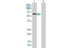 Lane 1: SASS6 transfected lysate ( 55.
