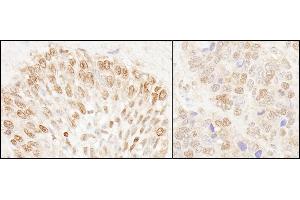 Immunohistochemistry (IHC) image for anti-Nucleoporin 50kDa (NUP50) (AA 418-468) antibody (ABIN7454785)