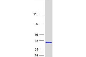 Validation with Western Blot