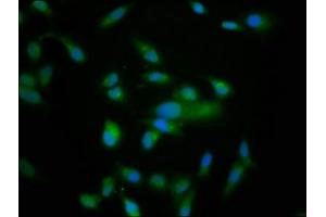 Immunofluorescence staining of Hela cells with ABIN7161047 at 1:166, counter-stained with DAPI. (NRD1 anticorps  (AA 32-113))